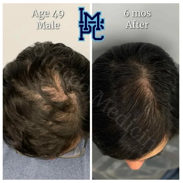 Topical Hair Treatment case 15