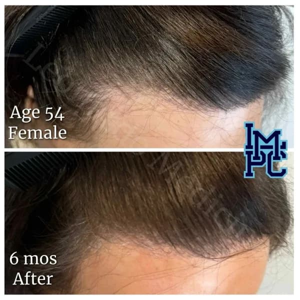 Topical Hair Treatment case 16