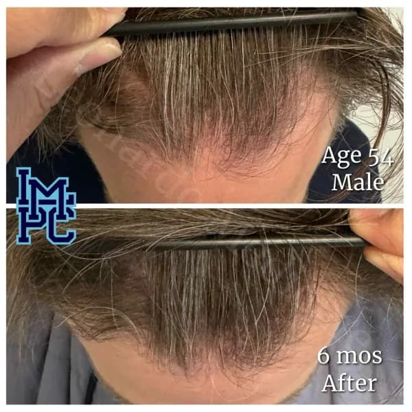 Topical Hair Treatment case 6