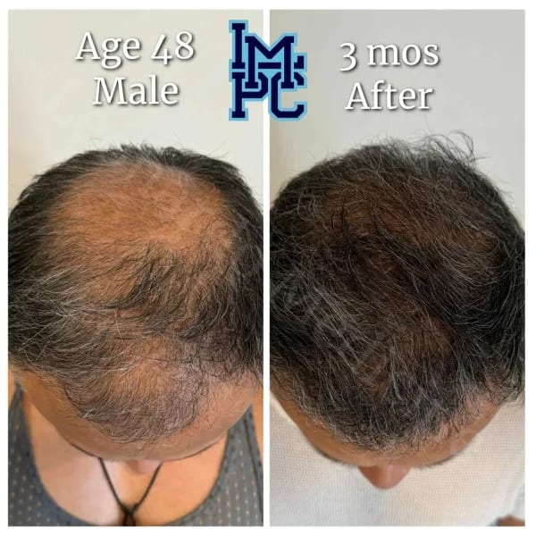 Topical Hair case 1