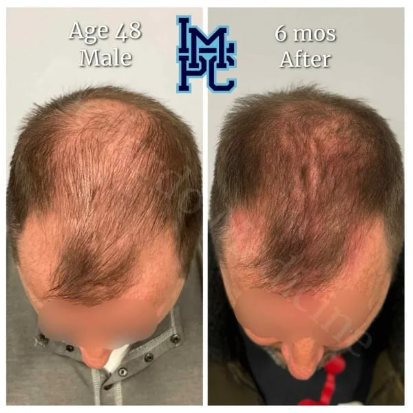 Topical Hair case 10
