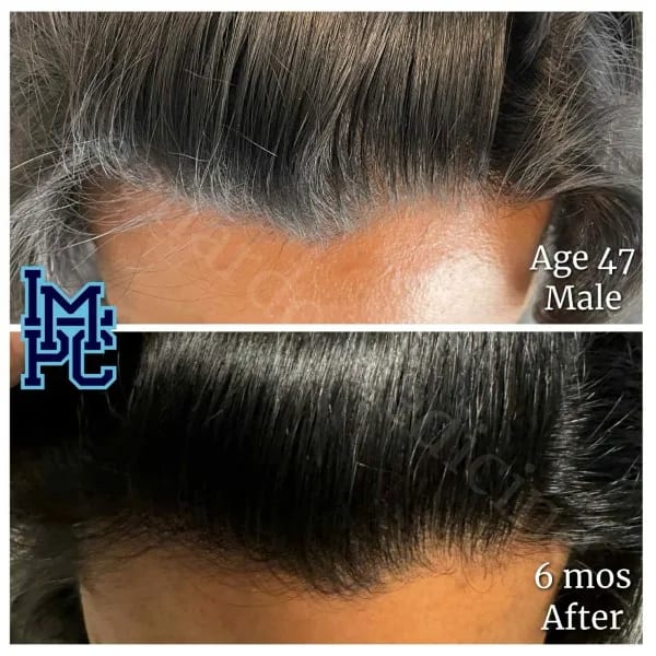 Topical Hair case 11