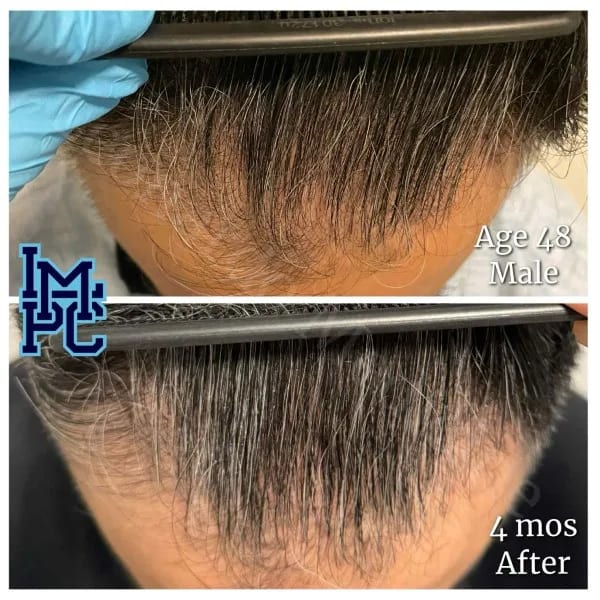 Topical Hair case 12