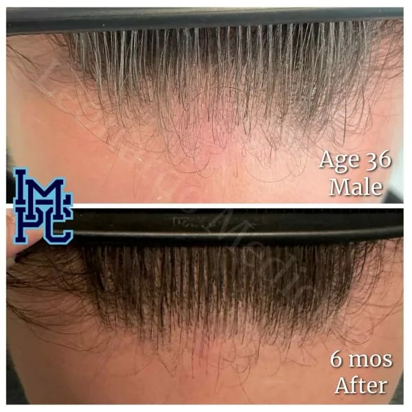 Topical Hair case 13