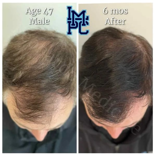 Topical Hair case 2
