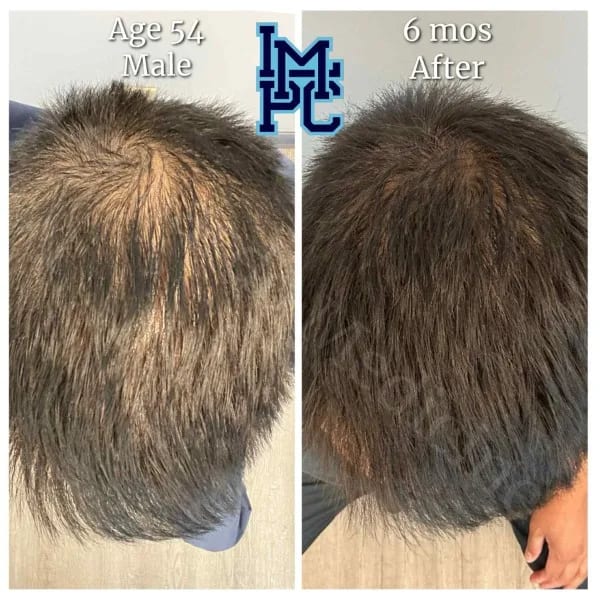 Topical Hair case 3