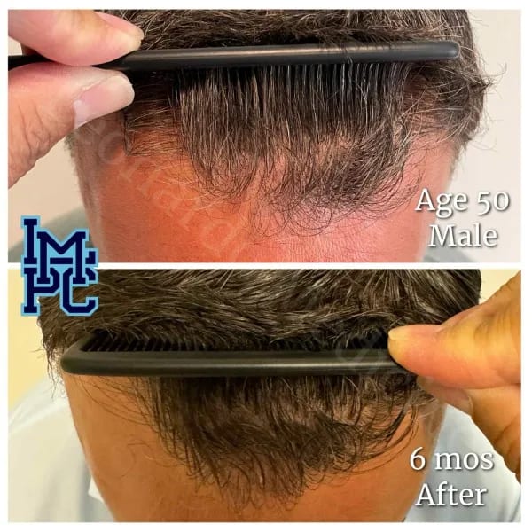 Topical Hair case 4