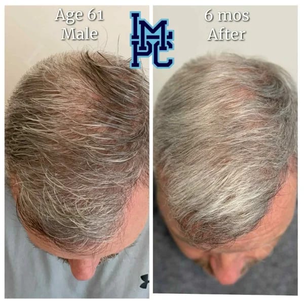 Topical Hair case 7