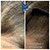Needleless Hair treatment 11 thumbnail