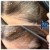 Needleless Hair treatment 21 thumbnail