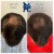 Topical Hair Treatment 8 thumbnail